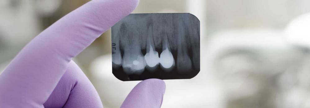 Prevenzione Odontoiatrica - Studio Dentistico Troiano Roma
